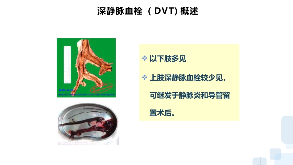 深静脉血栓的预防及护理ppt_第8页