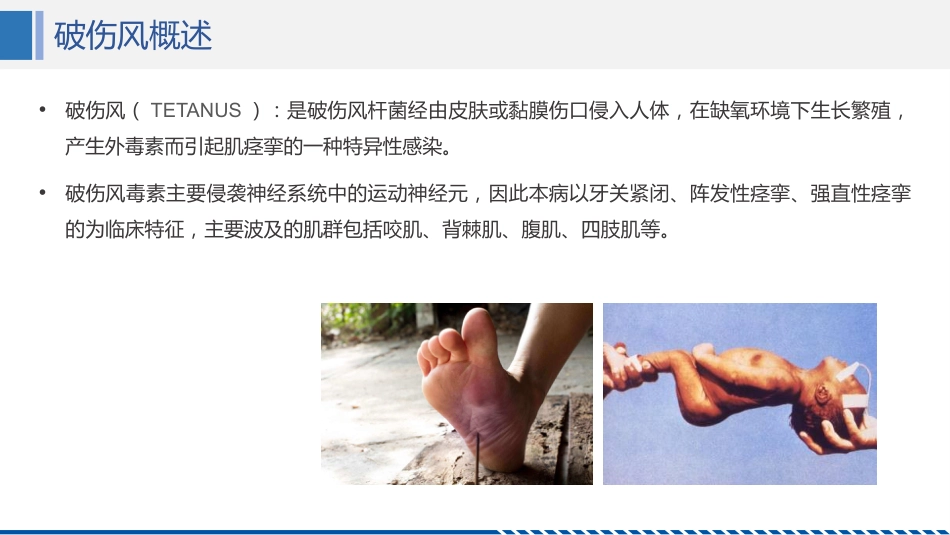 破伤风患者护理查房_第4页