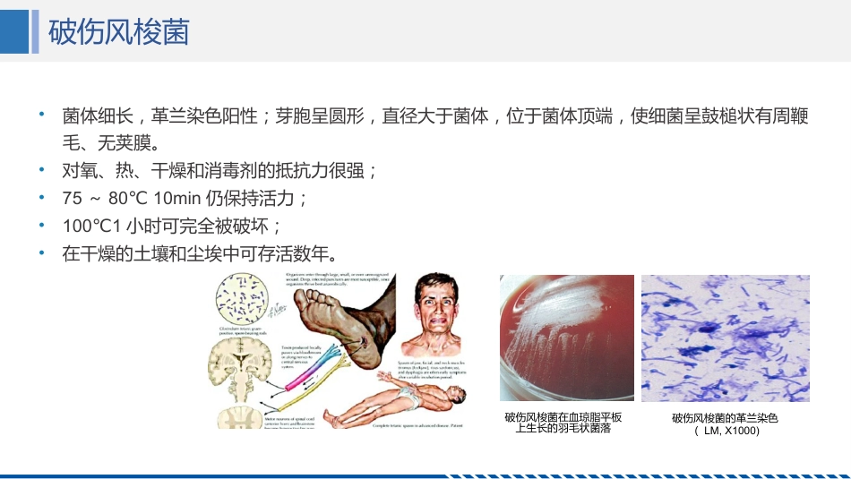 破伤风患者护理查房_第5页