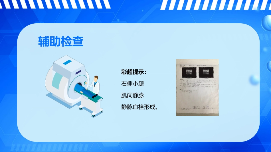 外科护理：下肢深静脉血栓的护理_第7页