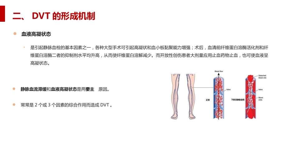深静脉血栓形成及肺栓塞的预防和护理_第5页