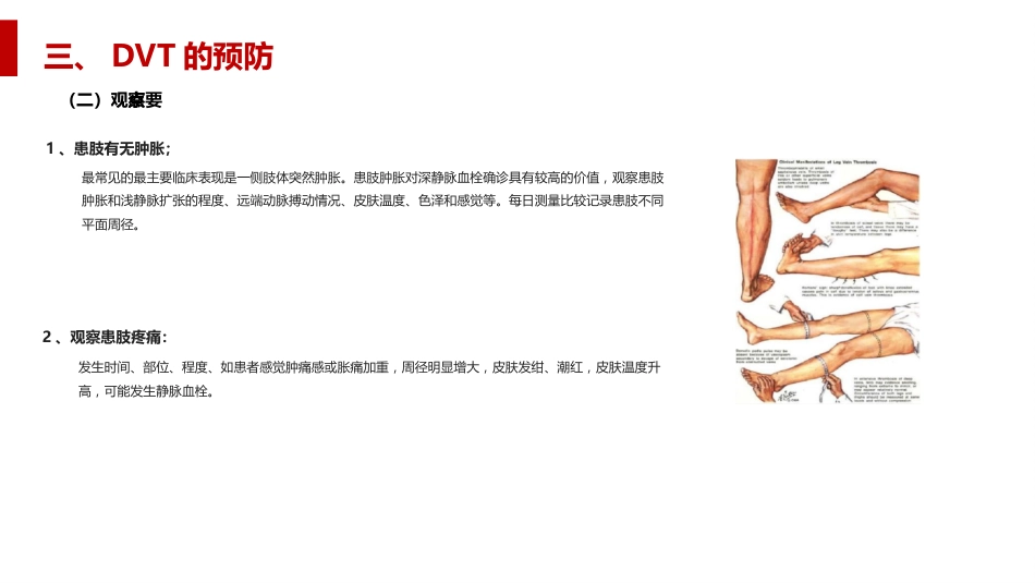 深静脉血栓形成及肺栓塞的预防和护理_第8页