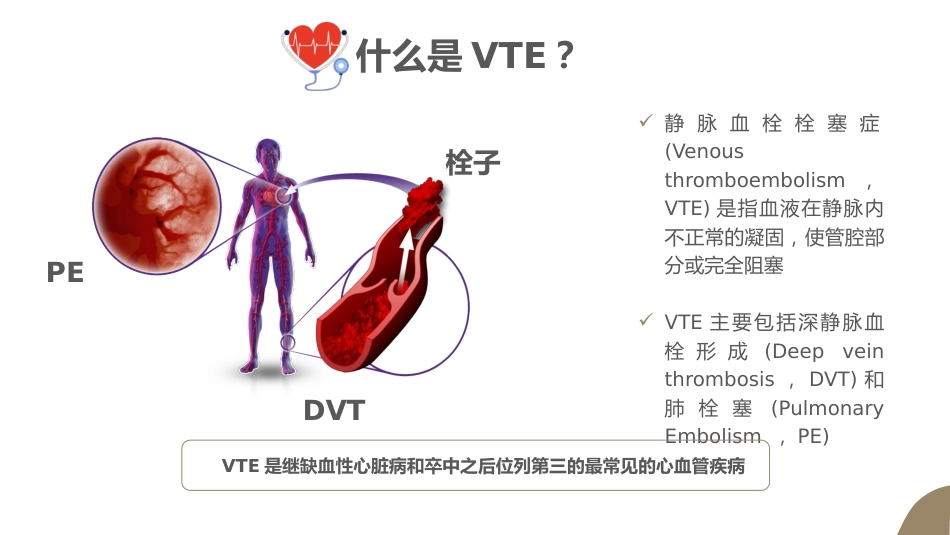 VTE的预防及护理课件ppt_第3页