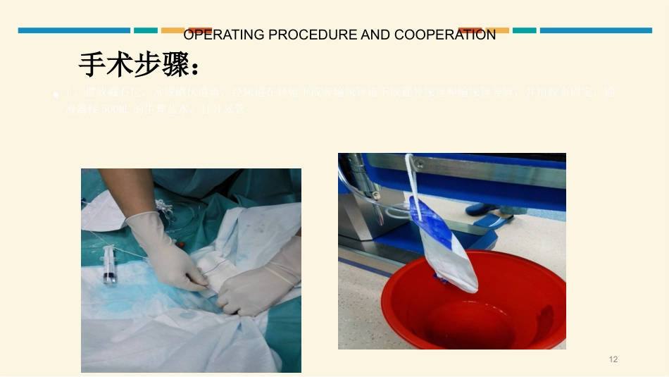 经皮肾镜碎石取石术护理配合PPT课件_第12页