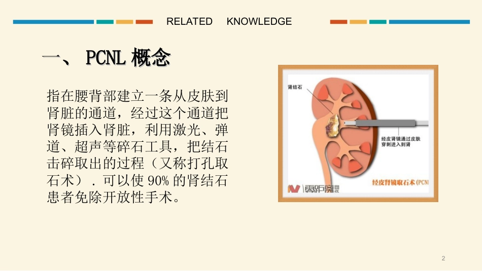 经皮肾镜碎石取石术护理配合PPT课件_第2页