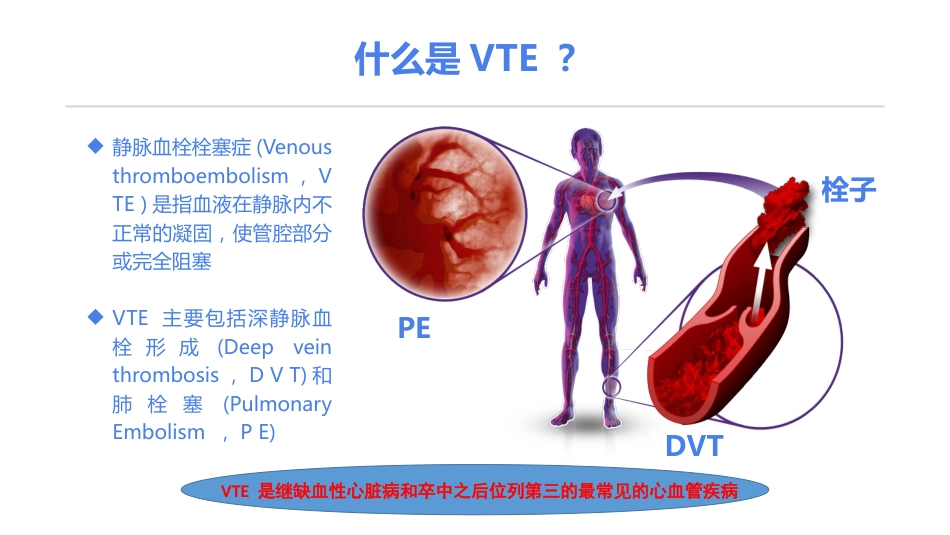 《住院患者静脉血栓栓塞症预防护理与管理专家共识》解读_第3页