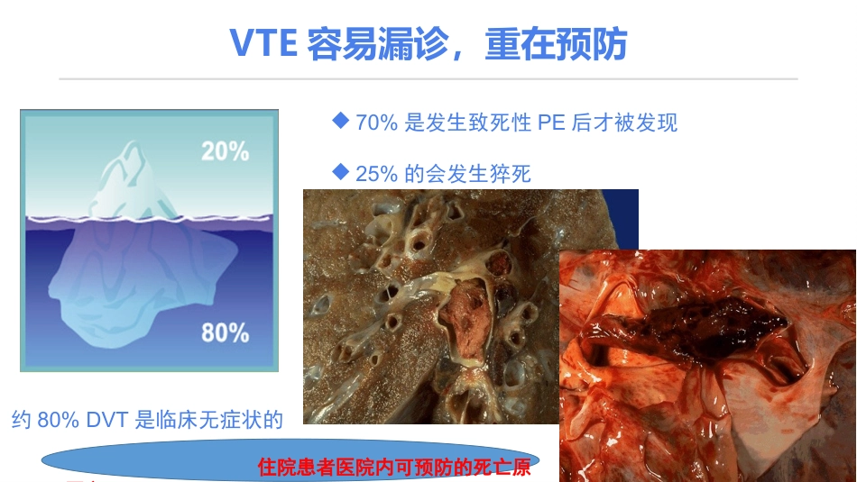 《住院患者静脉血栓栓塞症预防护理与管理专家共识》解读_第7页