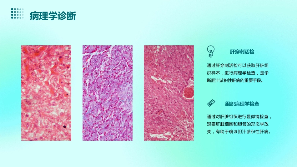胆汁淤积性肝病诊治专家共识_第14页