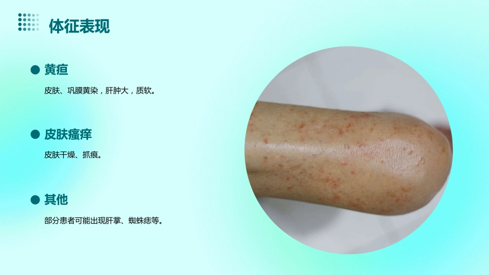 胆汁淤积性肝病诊治专家共识_第9页