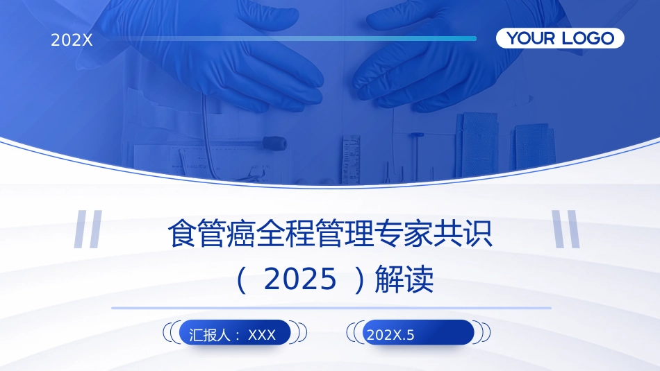 食管癌全程管理专家共识(2025)解读PPT课件_第1页
