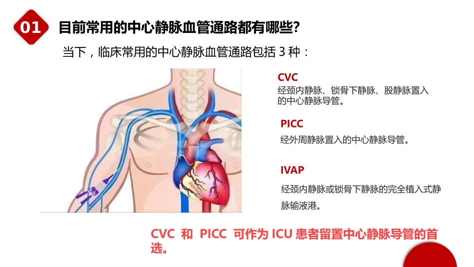 重症患者中心静脉导管管理中国专家共识(2022版)_第4页