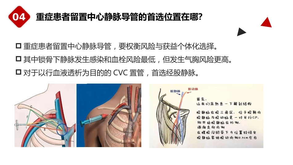 重症患者中心静脉导管管理中国专家共识(2022版)_第8页
