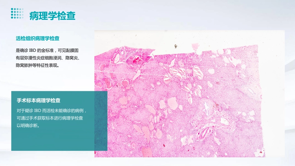 儿童炎症性肠病诊断和治疗专家共识解读PPT课件_第11页