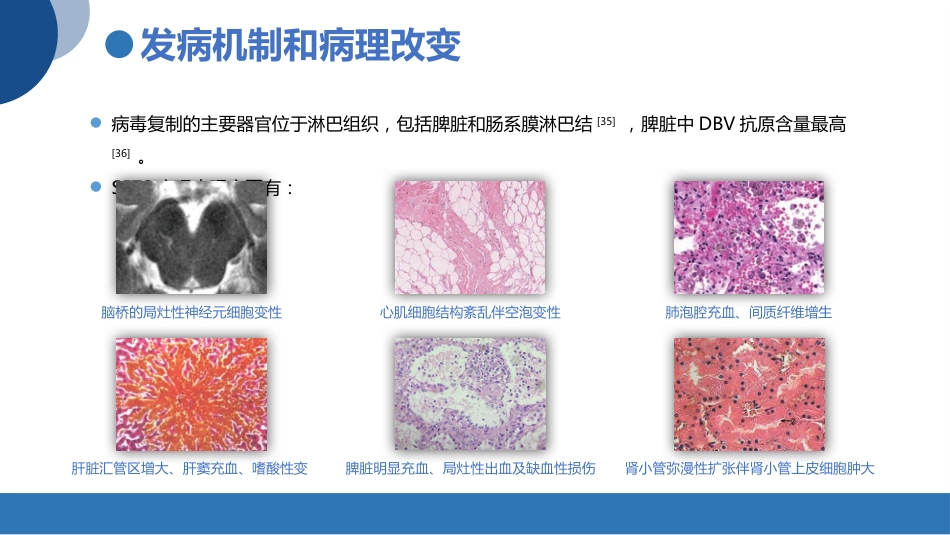 发热伴血小板减少综合征诊疗共识_第12页