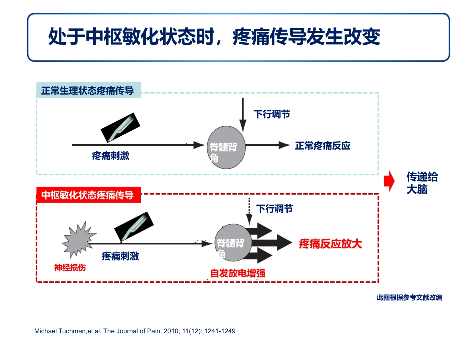 神经病理性疼痛诊疗专家共识解读幻灯_第15页