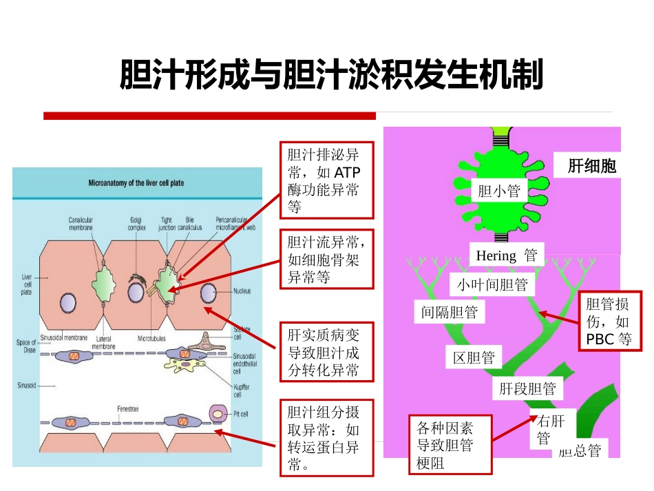 胆汁淤积性肝病治疗专家共识-_第6页