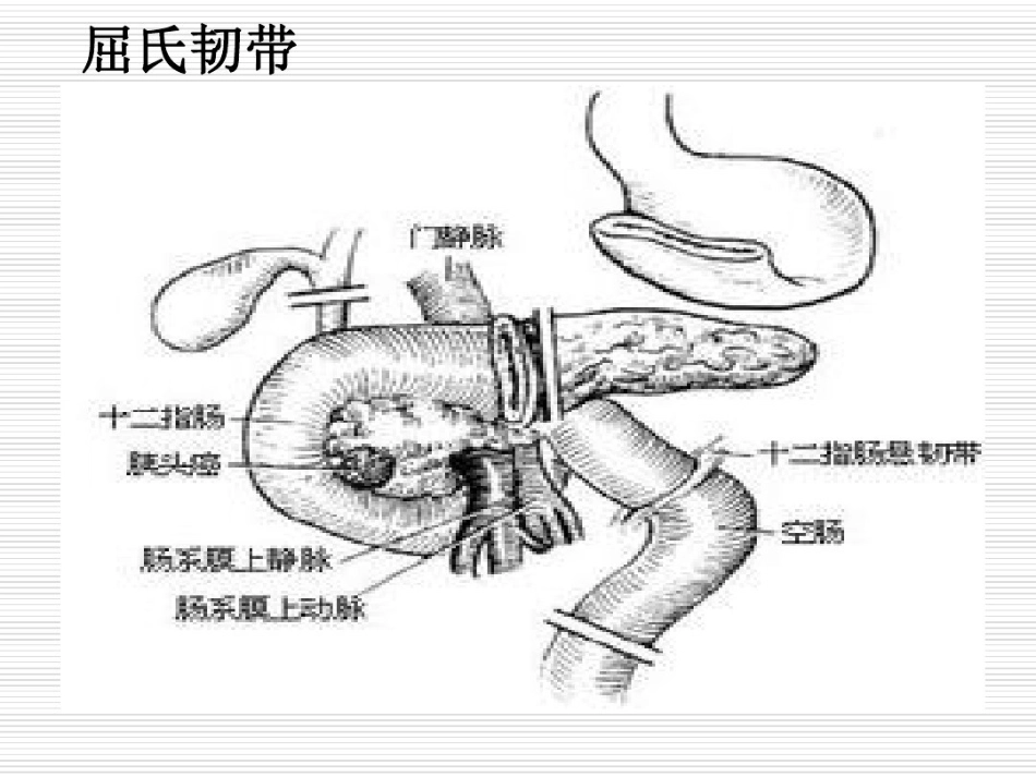 年急性上消化道出血专家共识_第3页