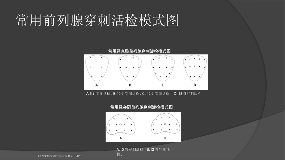 前列腺穿刺中国专家共识课件PPT课件_第13页