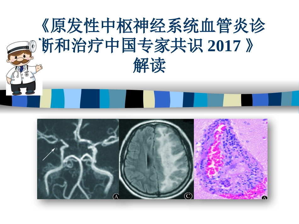 《原发性中枢神经系统血管炎诊断和治疗中国专家共识》解读医学PPT课件_第1页