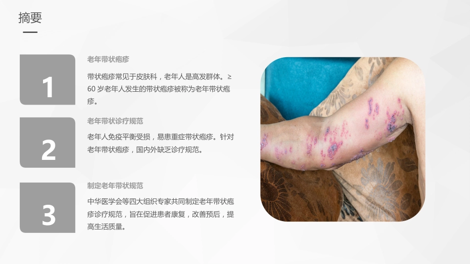 老年带状疱疹诊疗专家共识_第4页