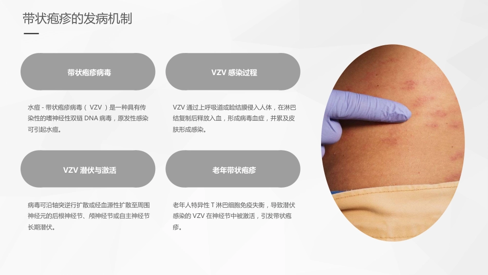 老年带状疱疹诊疗专家共识_第8页