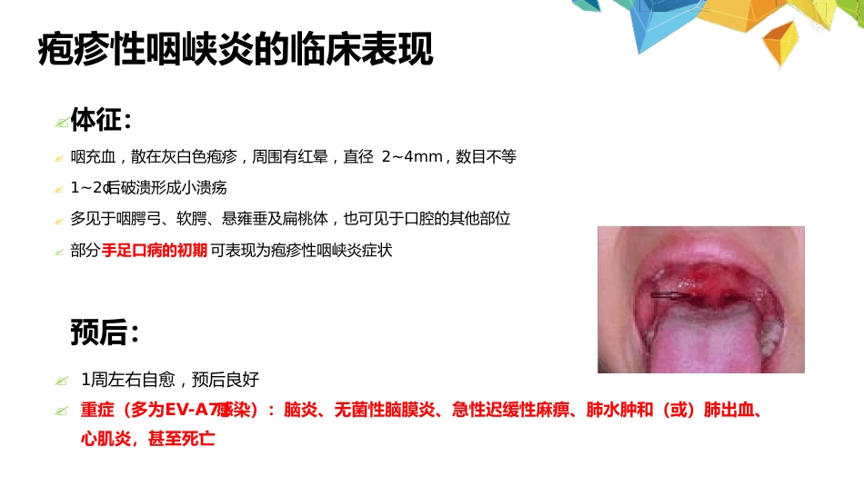 疱疹性咽峡炎诊断和治疗专家共识_第4页