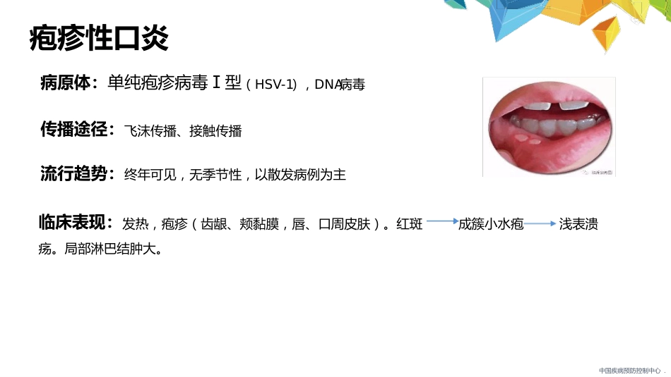 疱疹性咽峡炎诊断和治疗专家共识_第6页
