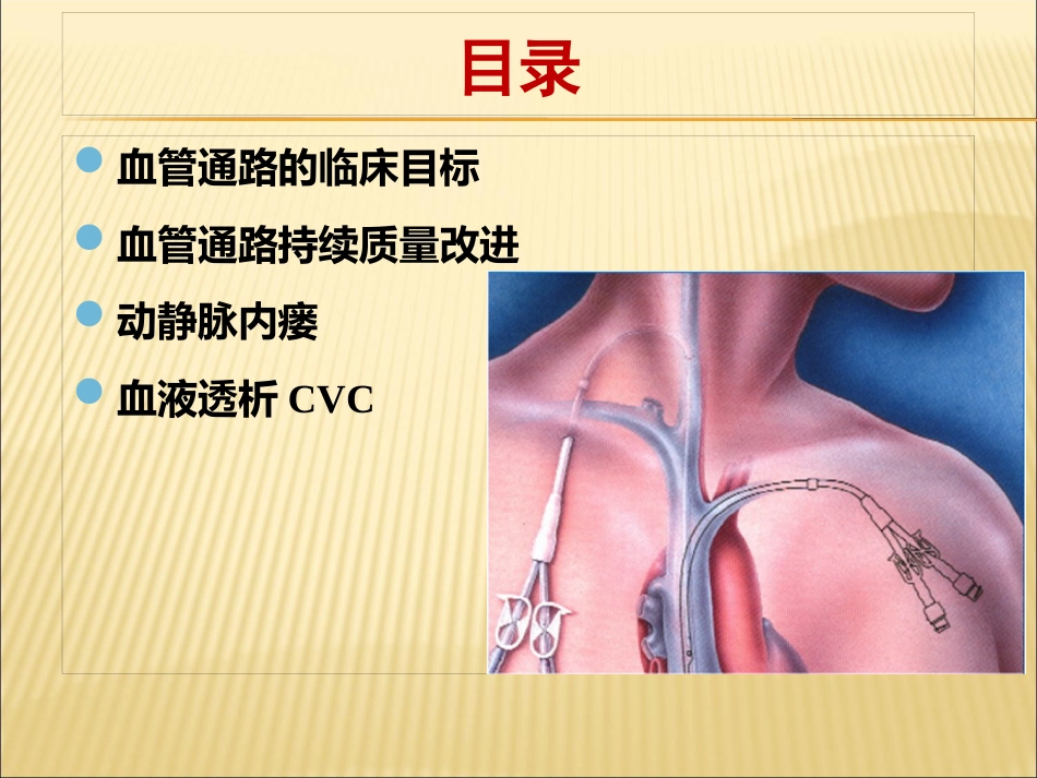 中国血液透析用血管通路专家共识_第3页