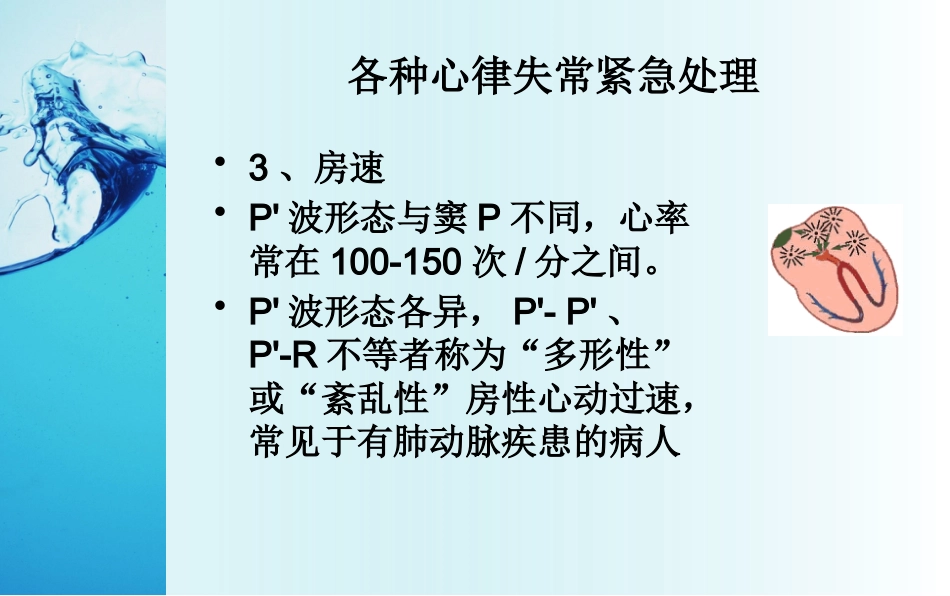 心律失常紧急处理专家共识_第13页