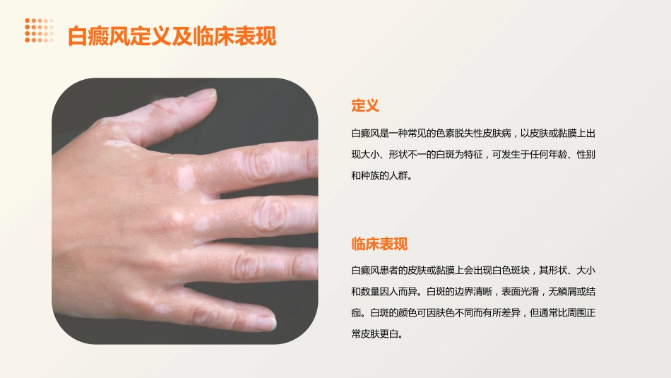 白癜风诊疗专家共识_第4页