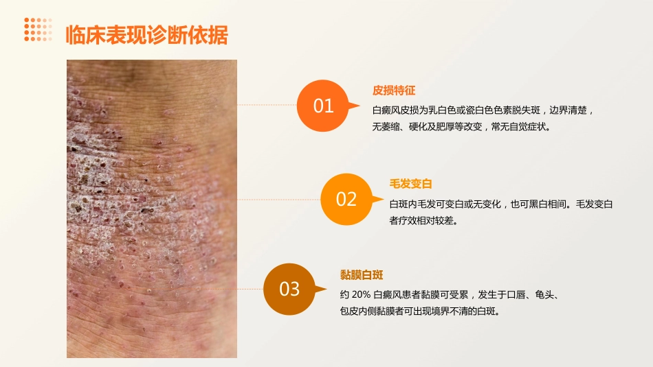 白癜风诊疗专家共识_第8页