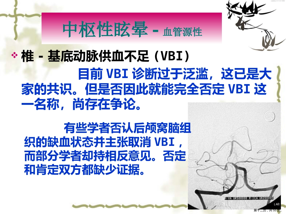 眩晕规范化治疗专家共识_第12页