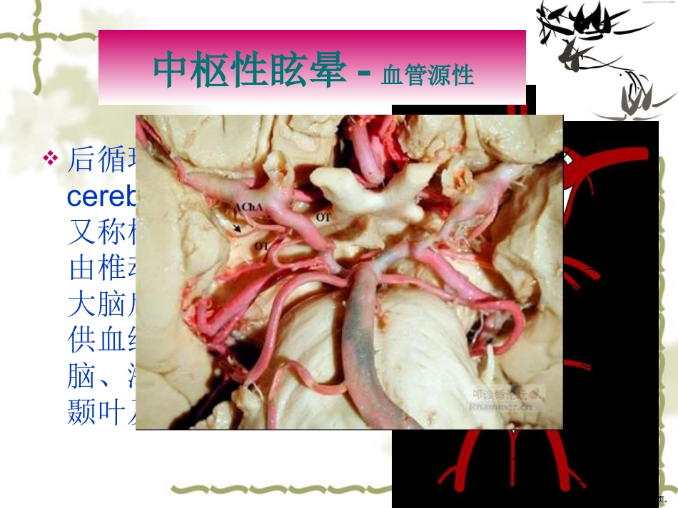 眩晕规范化治疗专家共识_第14页