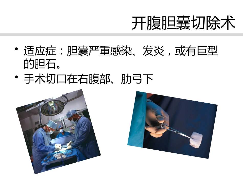 胆囊息肉诊治共识_第14页