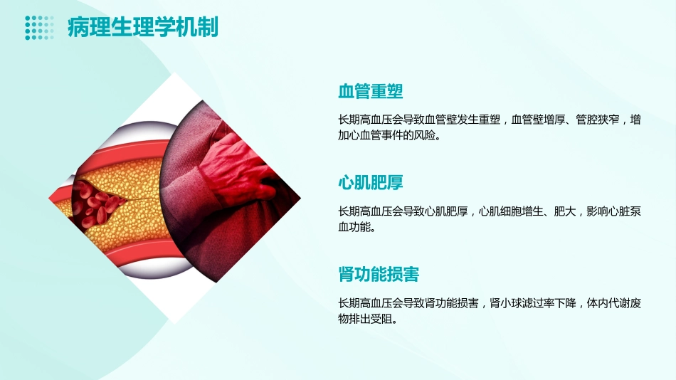 2023版难治性高血压诊断治疗中国专家共识ppt课件_第13页