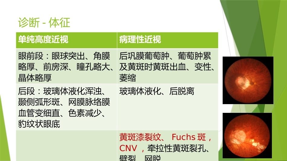 高度近视防控专家共识_第6页