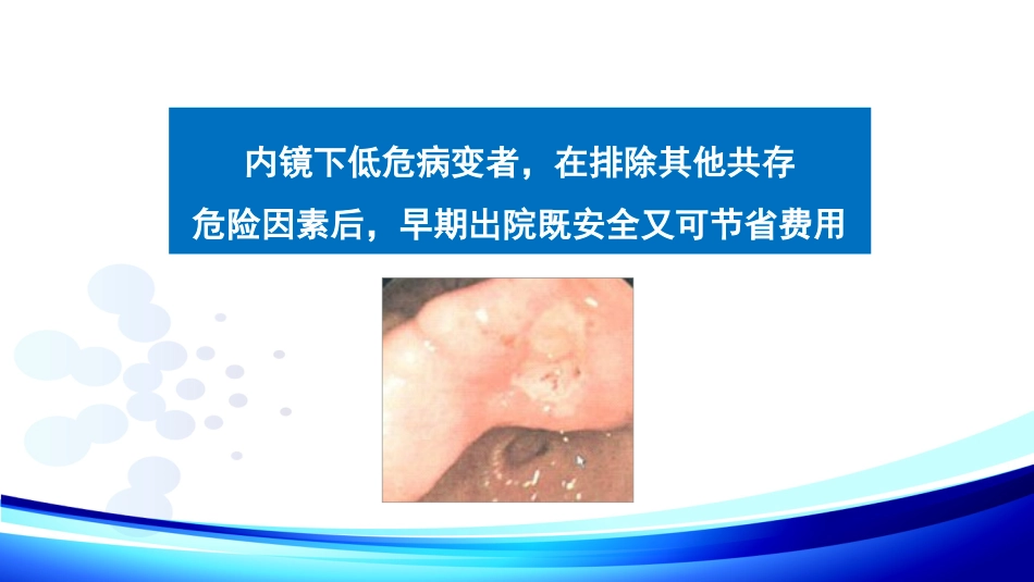 《上消化道出血专家共识》最新解读_第8页