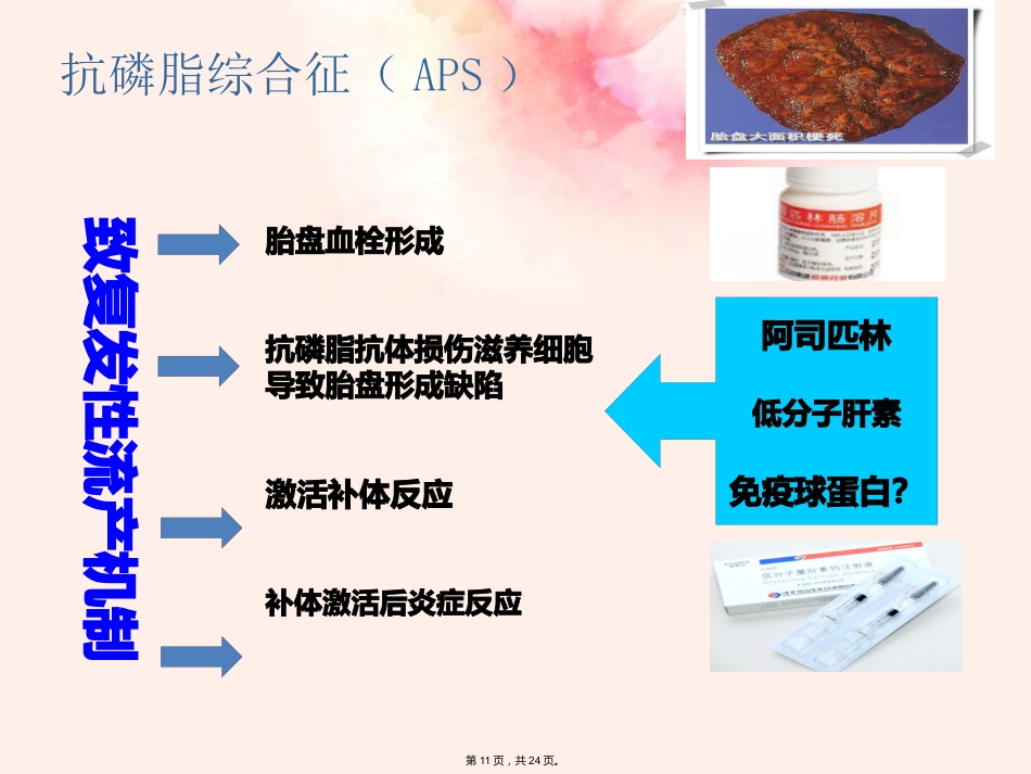 复发性流产的专家共识最新(详细分析“流产”共24张)_第11页