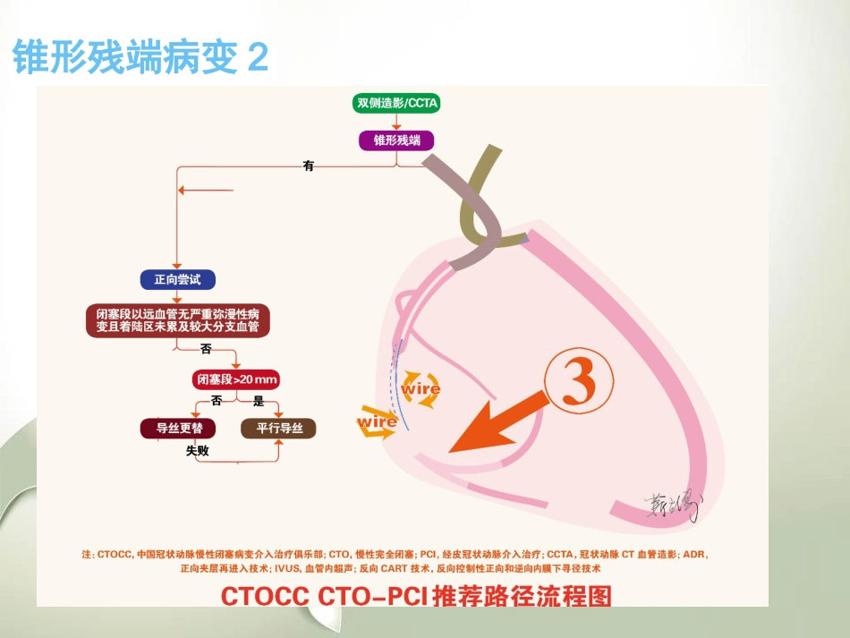 CTO介入治疗处理流程与最新专家共识_第11页