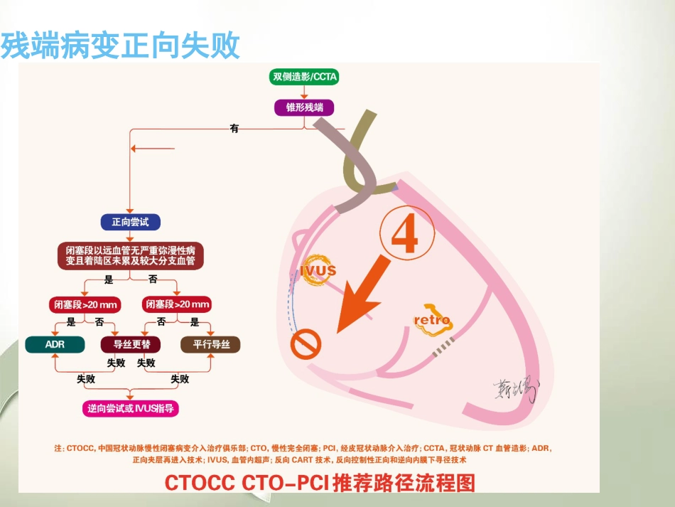 CTO介入治疗处理流程与最新专家共识_第12页