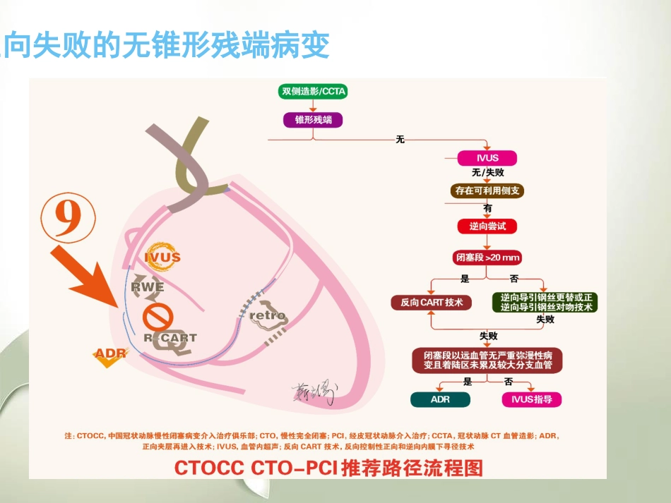 CTO介入治疗处理流程与最新专家共识_第15页