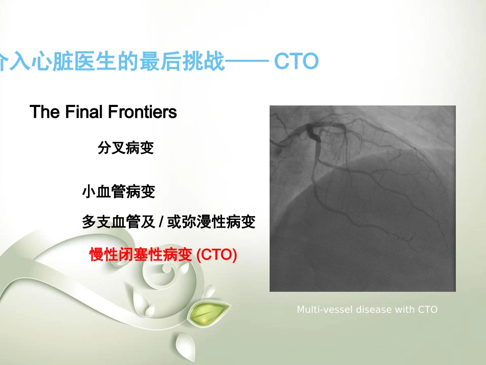 CTO介入治疗处理流程与最新专家共识_第2页