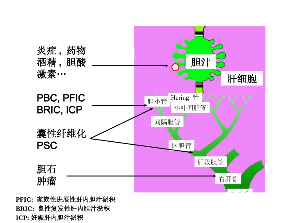 《胆汁淤积性肝病治疗专家共识》解读_第8页