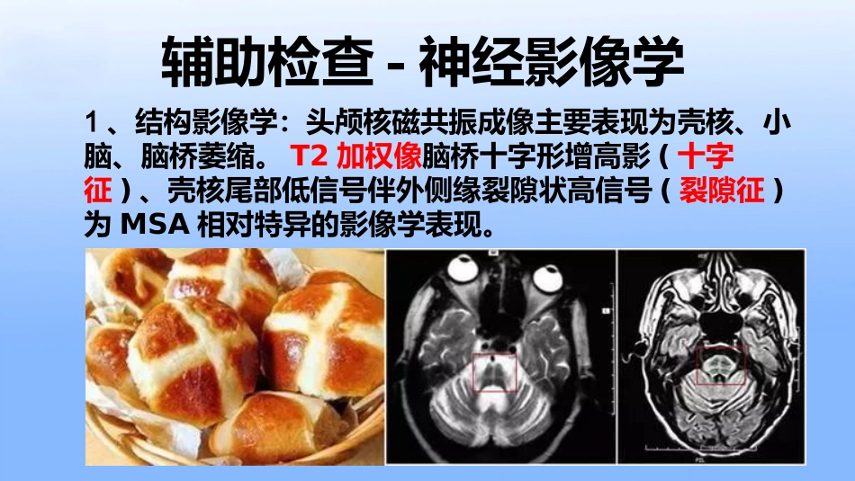 多系统萎缩专家共识_第10页