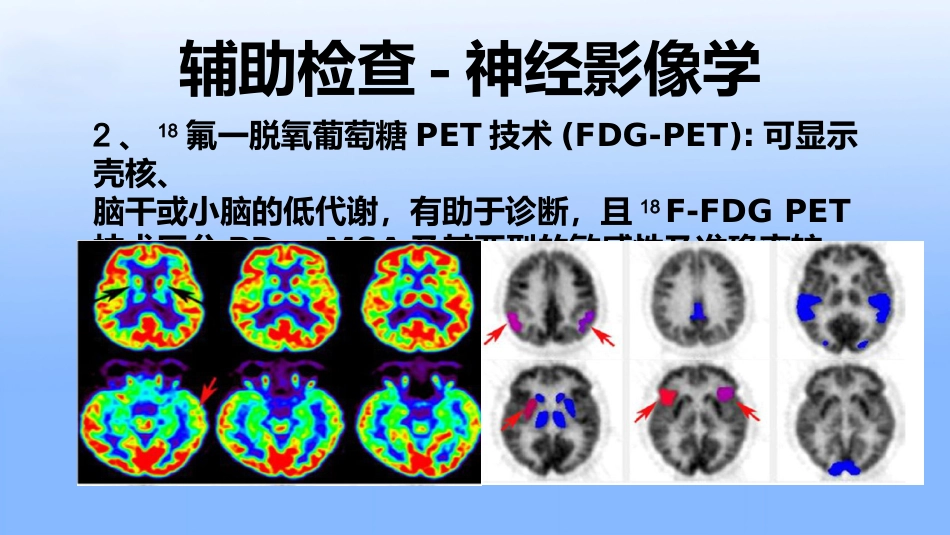 多系统萎缩专家共识_第12页