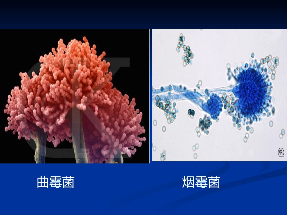 肺部真菌病诊断和治疗专家共识_第5页