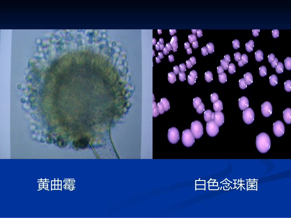 肺部真菌病诊断和治疗专家共识_第6页