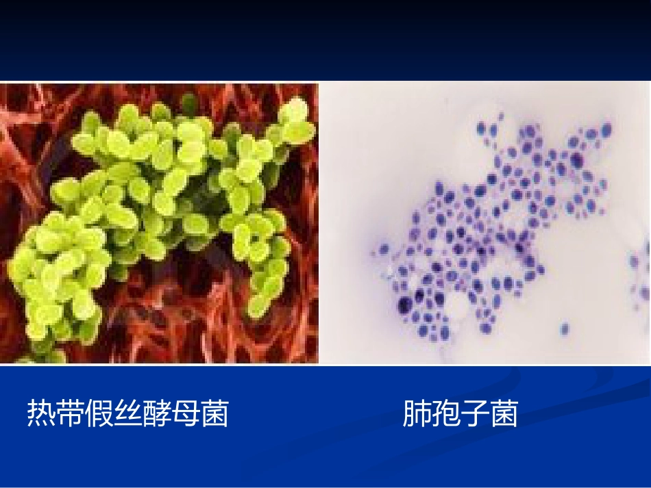 肺部真菌病诊断和治疗专家共识_第7页