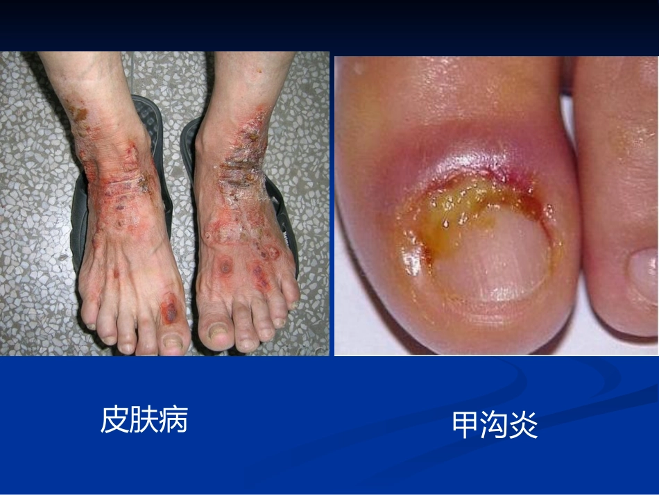 肺部真菌病诊断和治疗专家共识_第8页