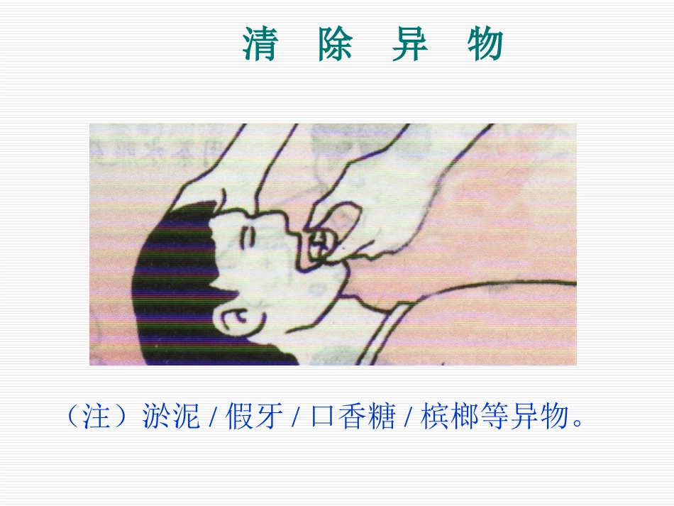 安全健康讲座(修订)_第12页